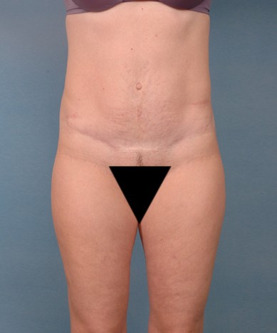 After Image