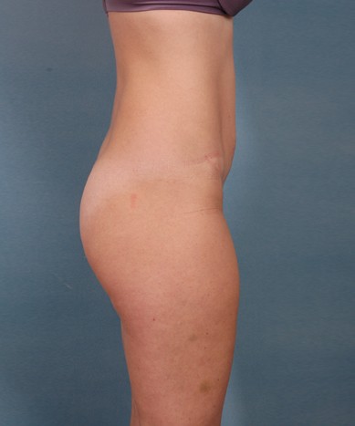 After Image