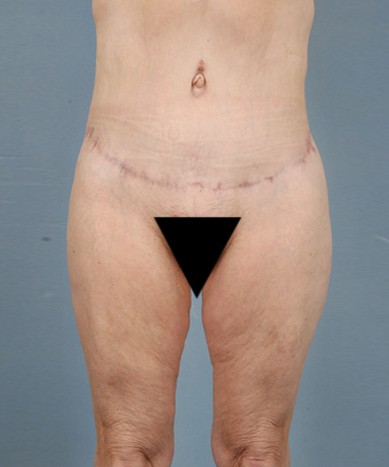 After Image