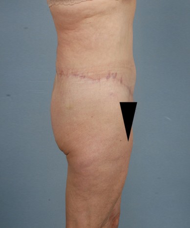 After Image