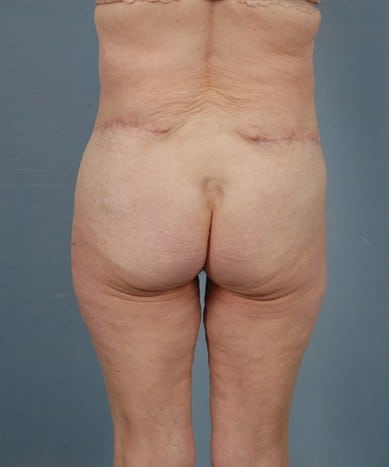 After Image