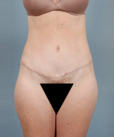 After Image