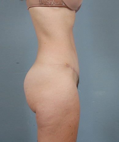 After Image
