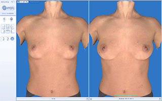 breast augmentation computer Latex beds reviews