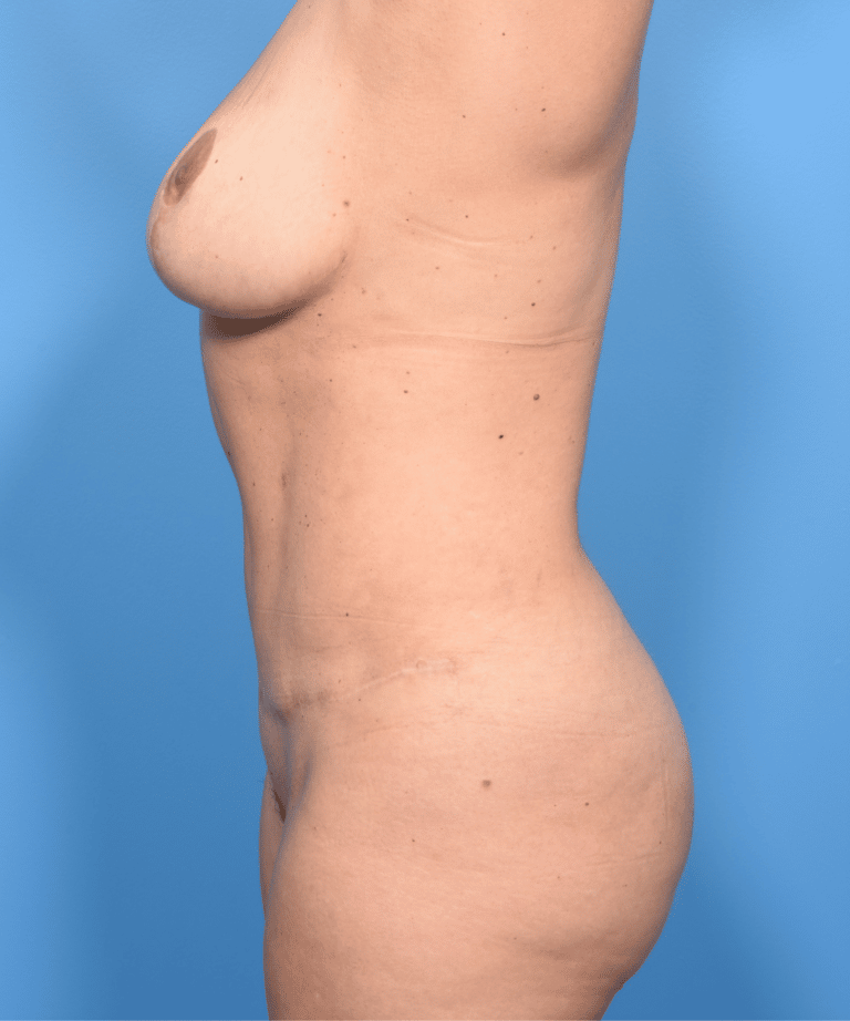 After Image