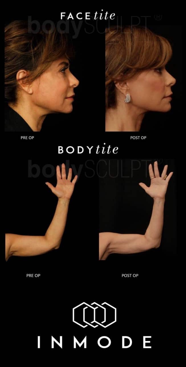 0c7ddeedd4f4481a5e031f6d6429fa4d.paula beforeafter