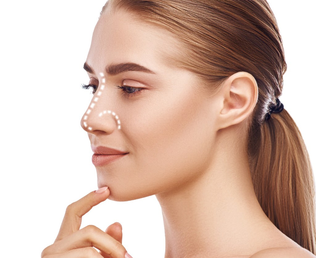 rhinoplasty nose surgery side view of attractive young woman with picture id1142167563 1