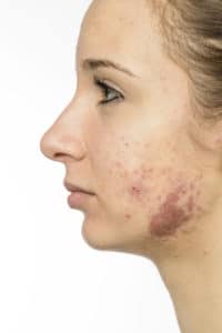 istock 481391791