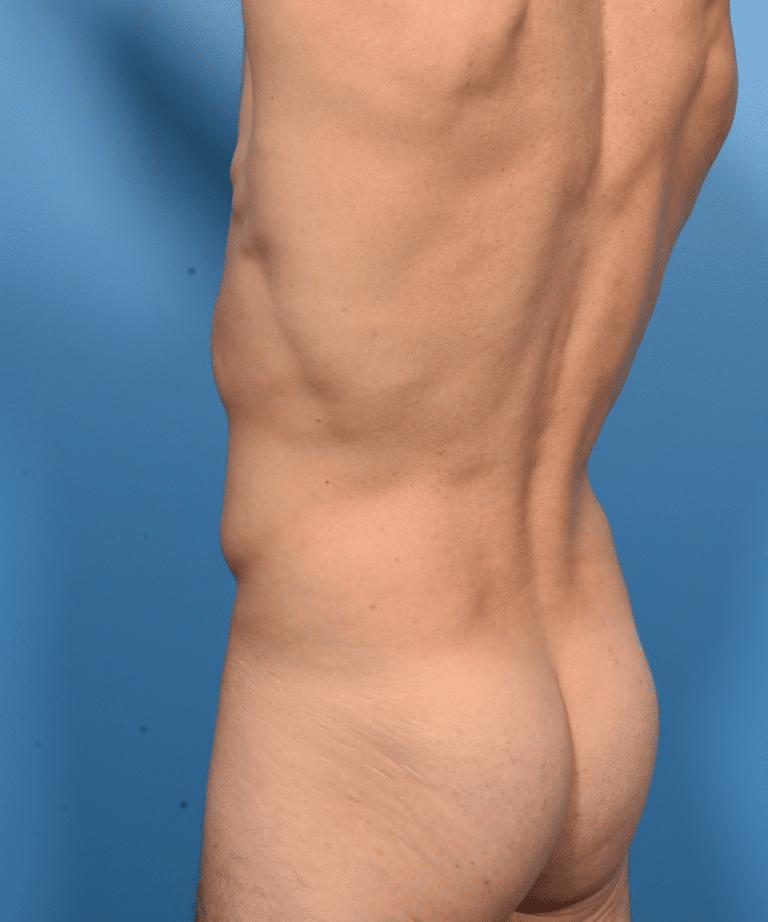 After Image