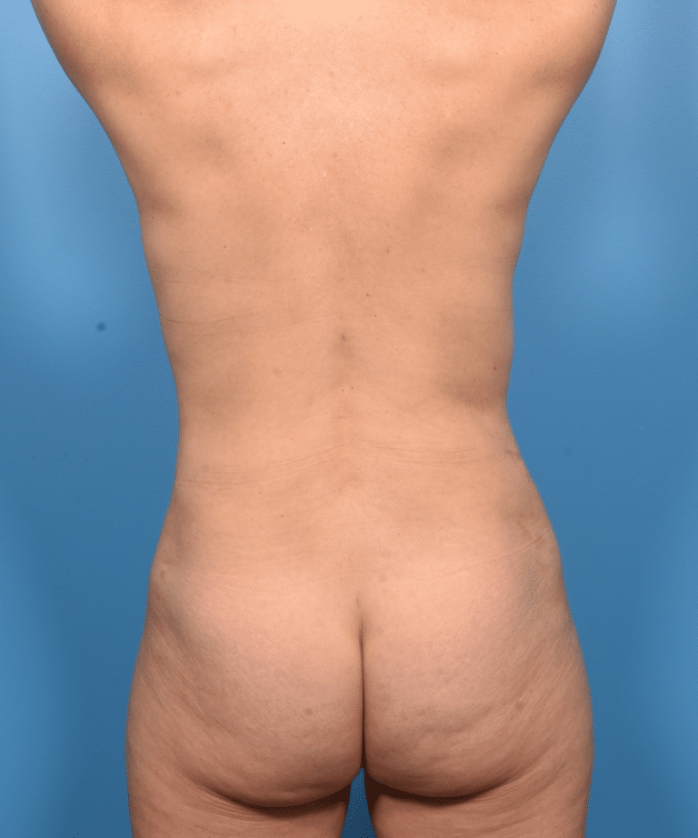 After Image