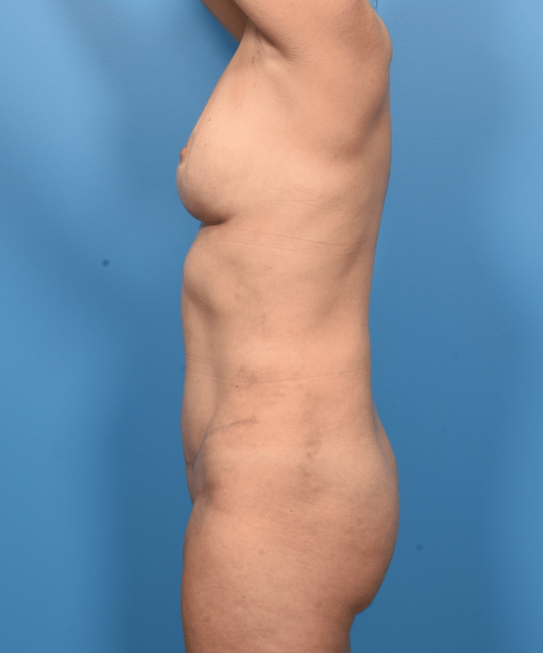 After Image