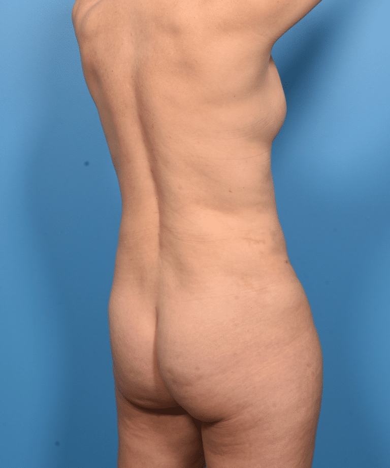 After Image