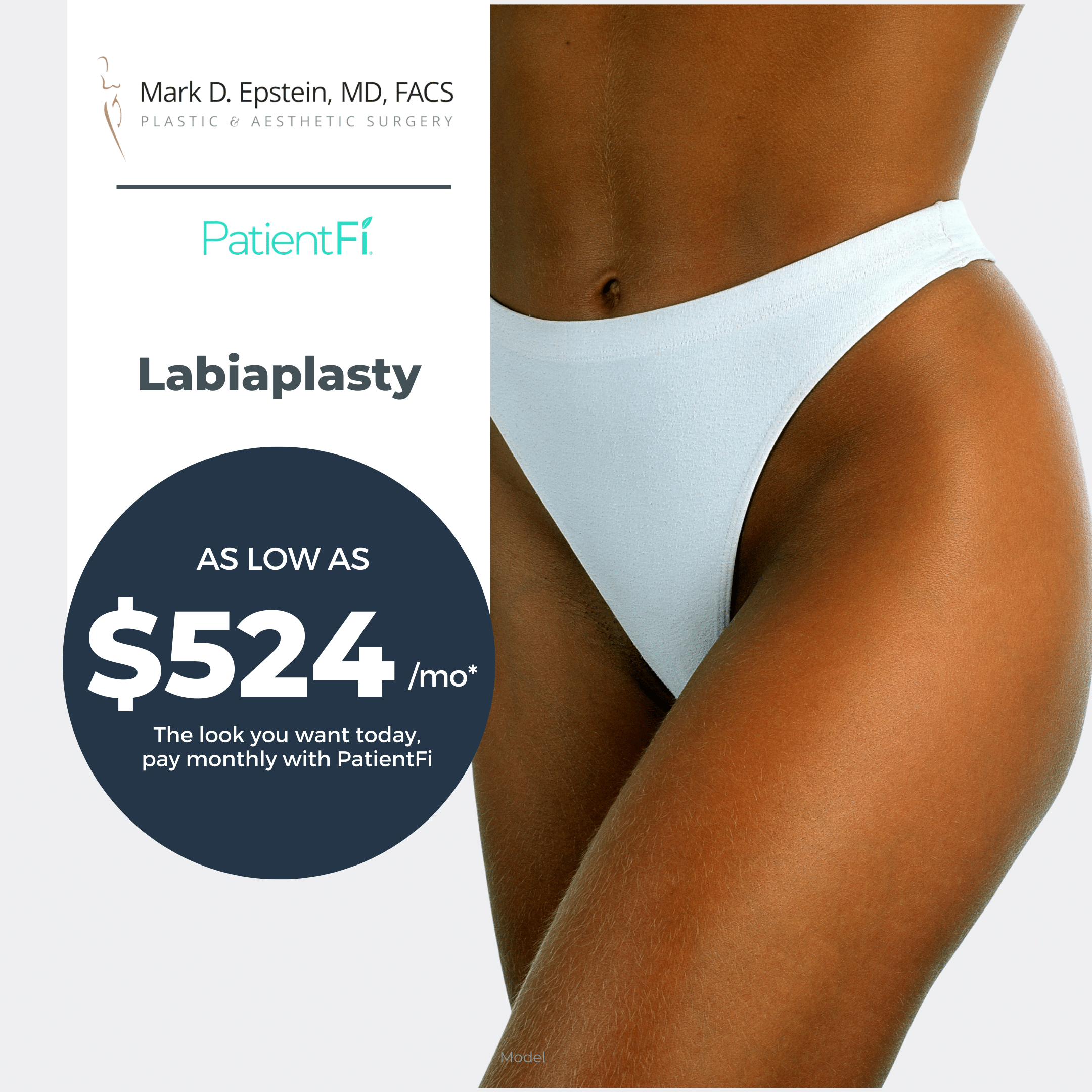 Labiaplasty