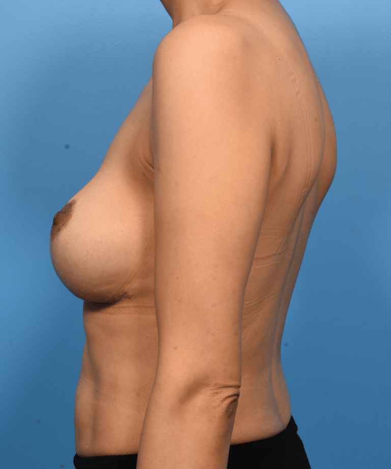 After Image