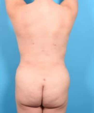 After Image
