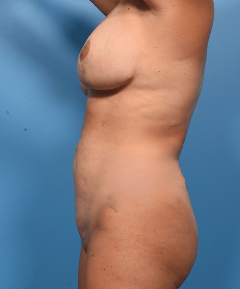 After Image