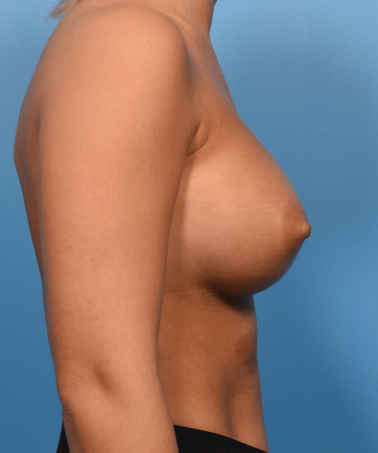 After Image