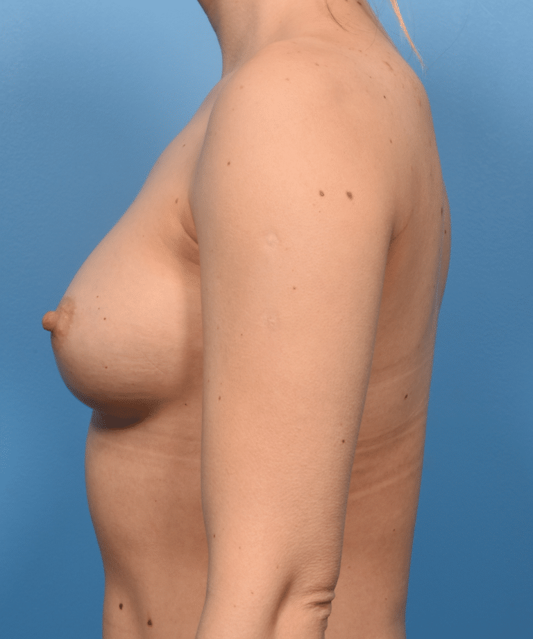 After Image
