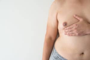 A close-up shot of a man's chest before male breast reduction surgery