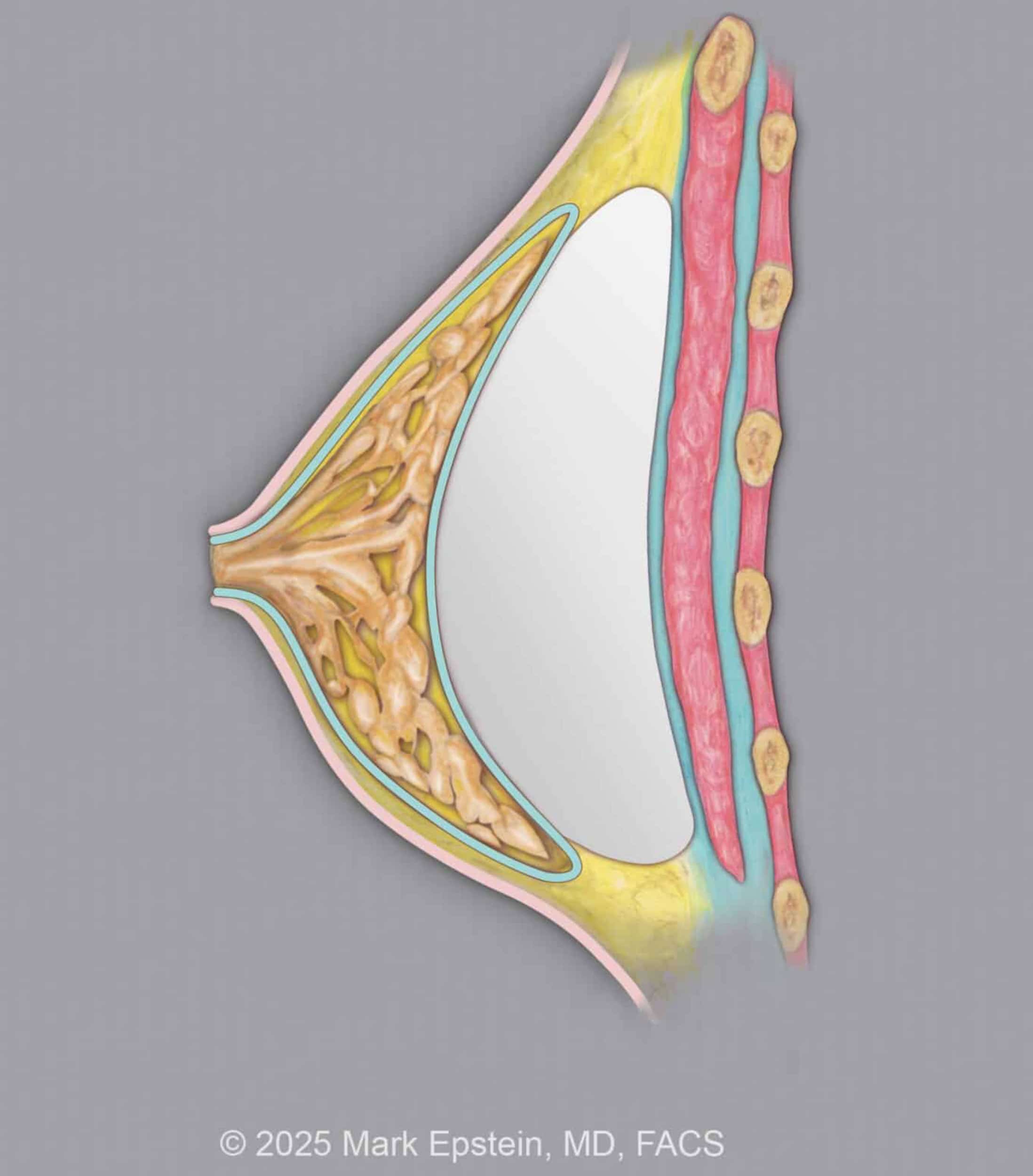 Implant © 600 dpi ABOVE