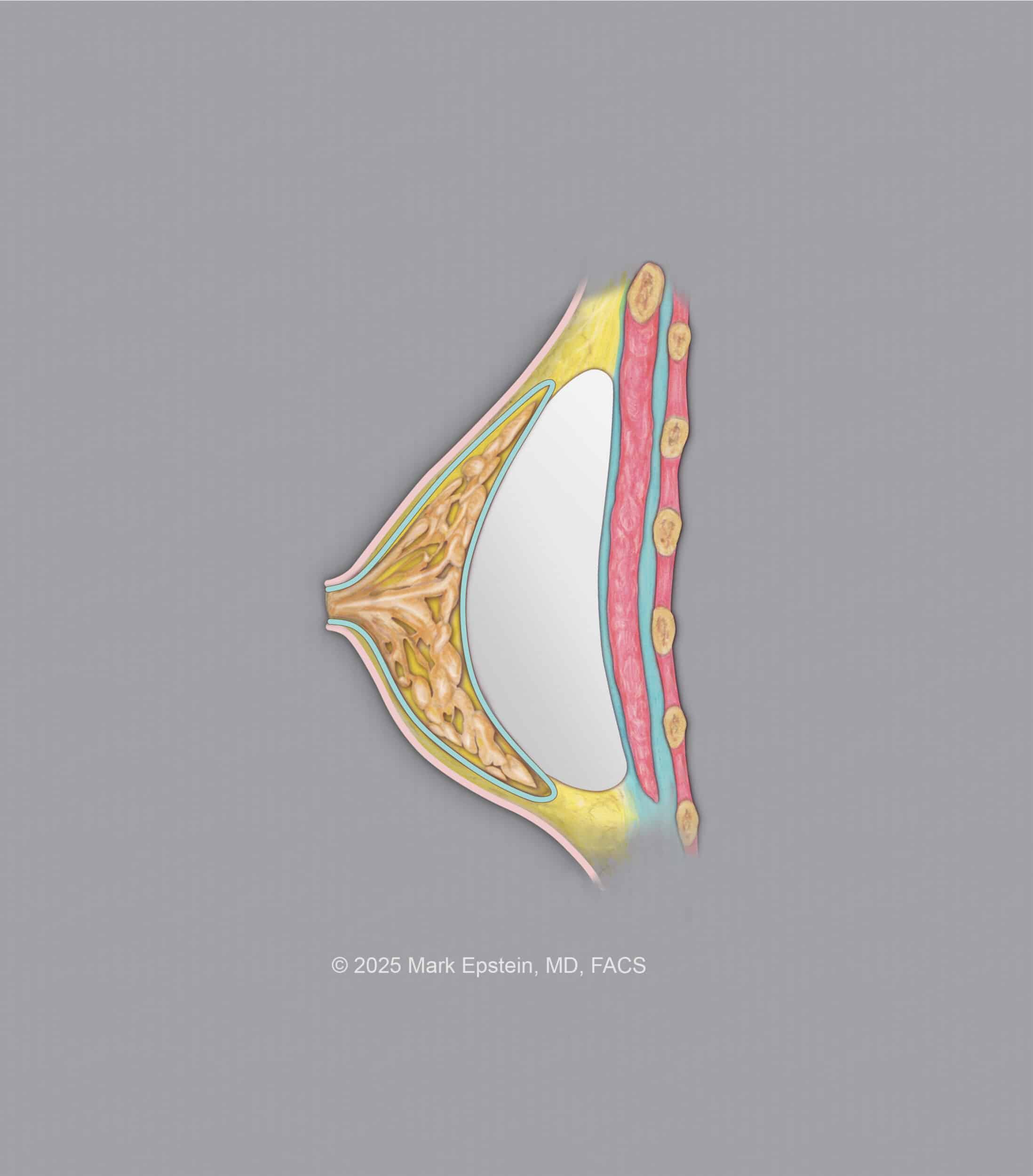 Implant © 600 dpi ABOVE