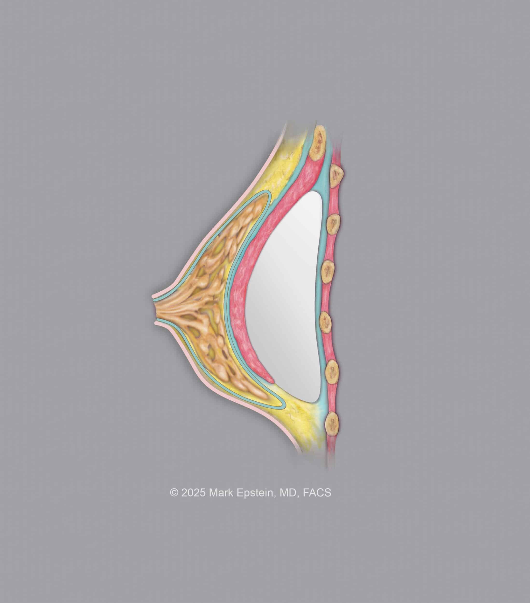 Implant © 600 dpi BELOW