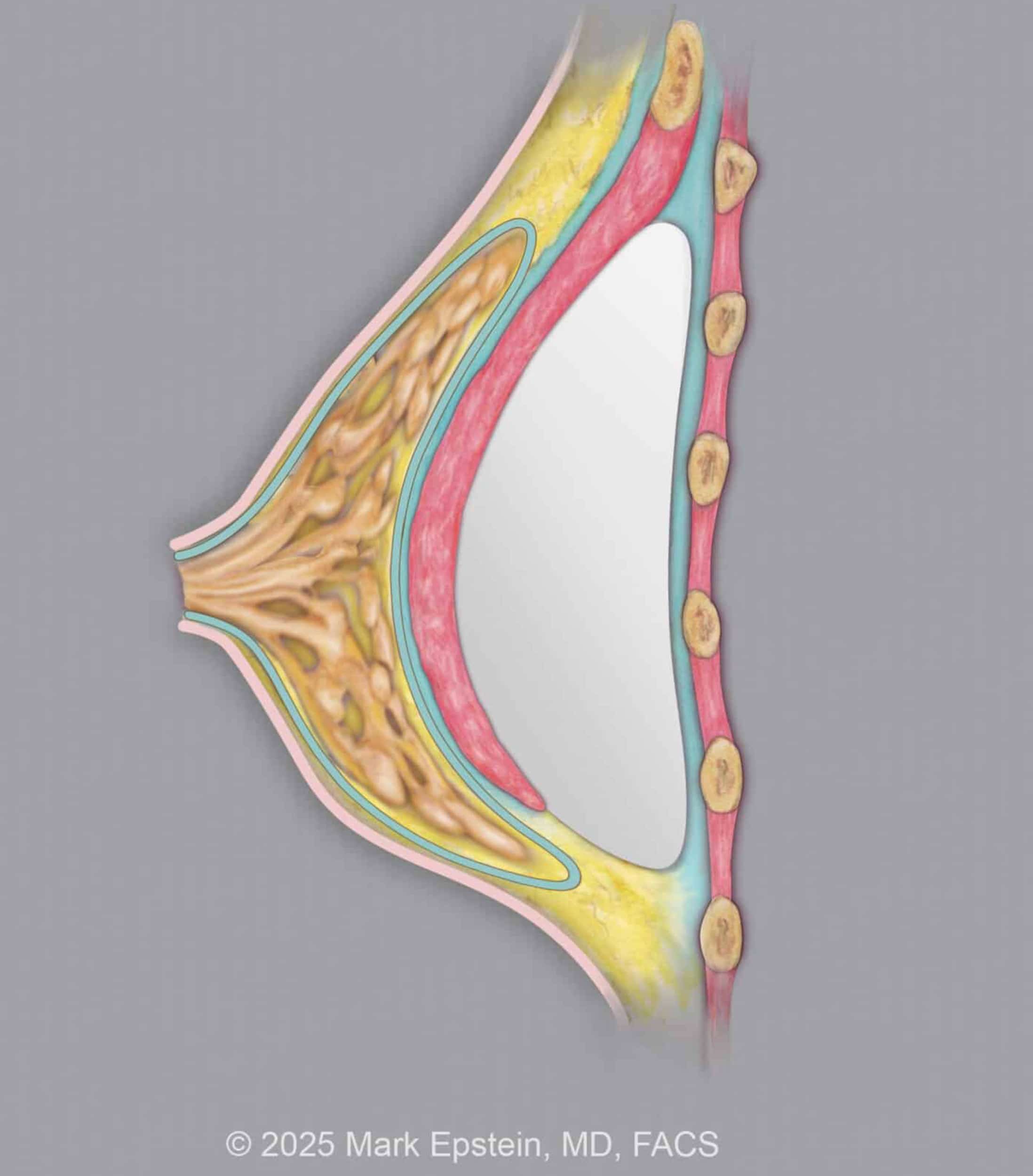 Implant © 600 dpi BELOW