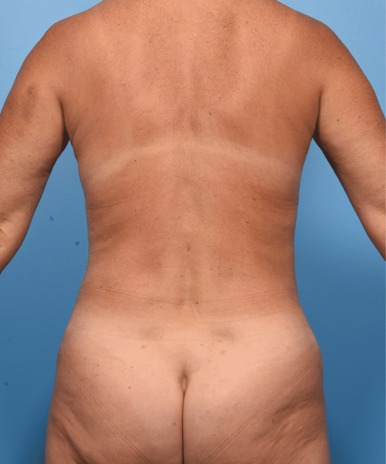 After Image