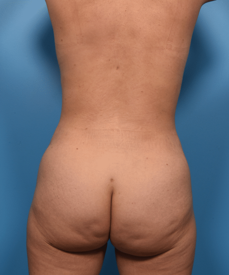 After Image