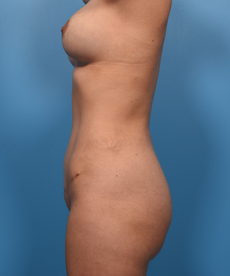 After Image