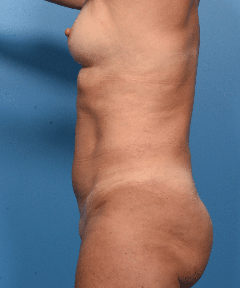 After Image