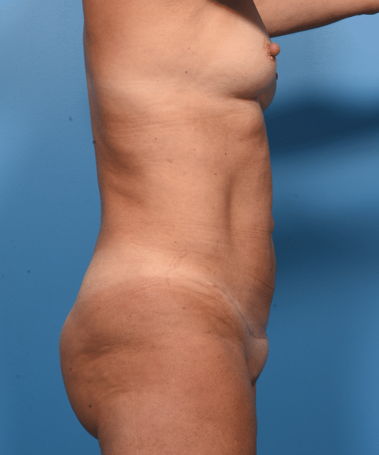 After Image