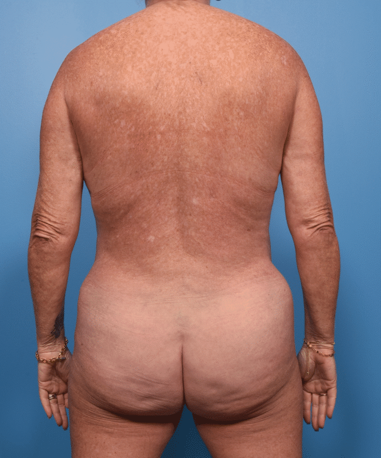 After Image