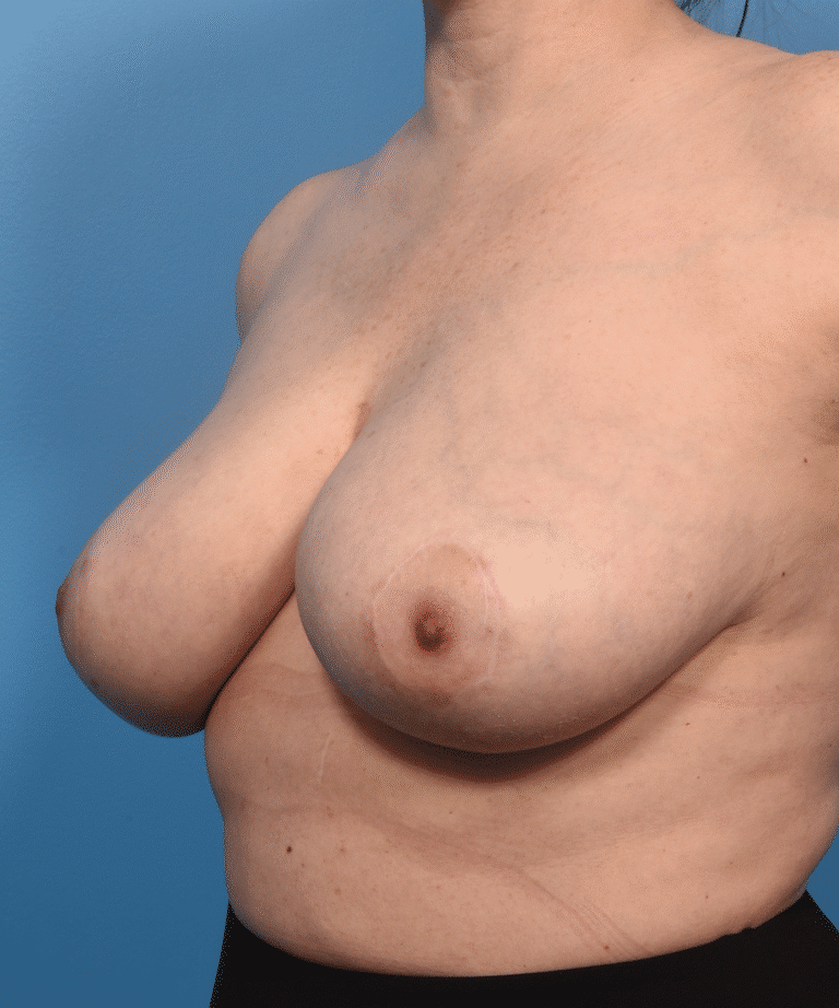 After Image