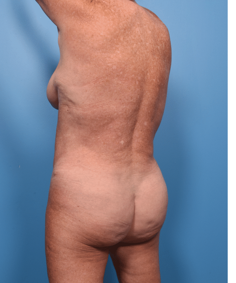 After Image