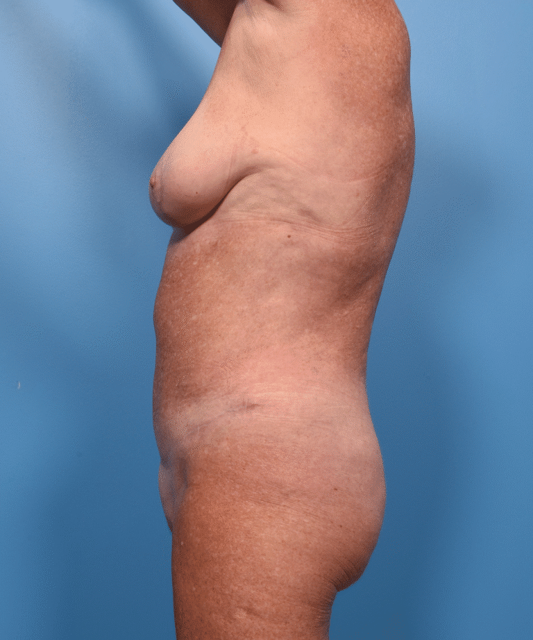 After Image
