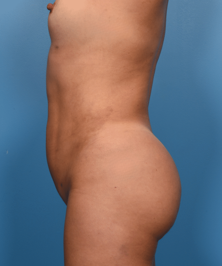 After Image