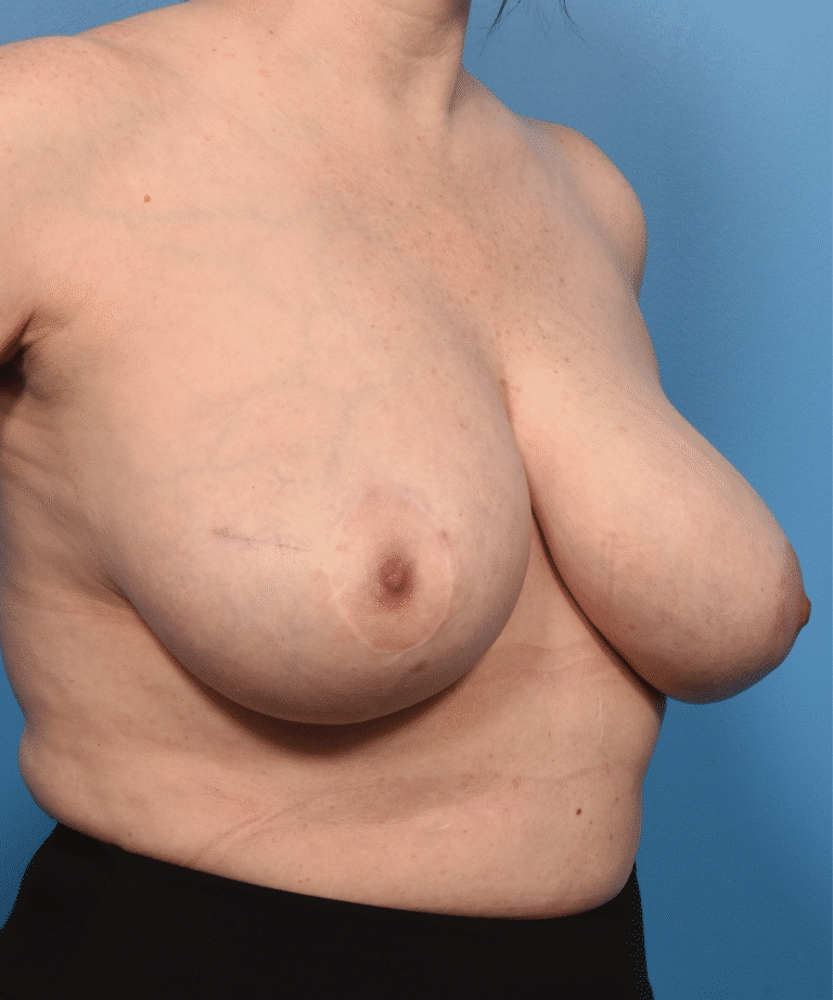 After Image