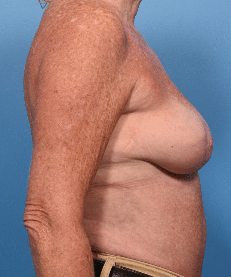 After Image