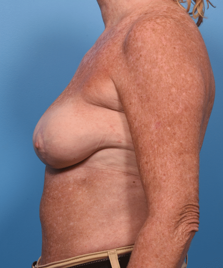 After Image