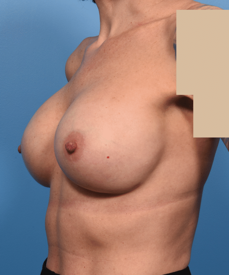 After Image