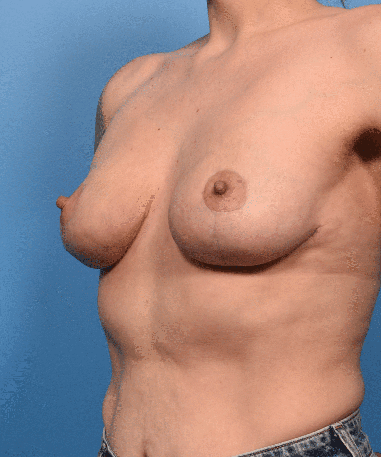 After Image