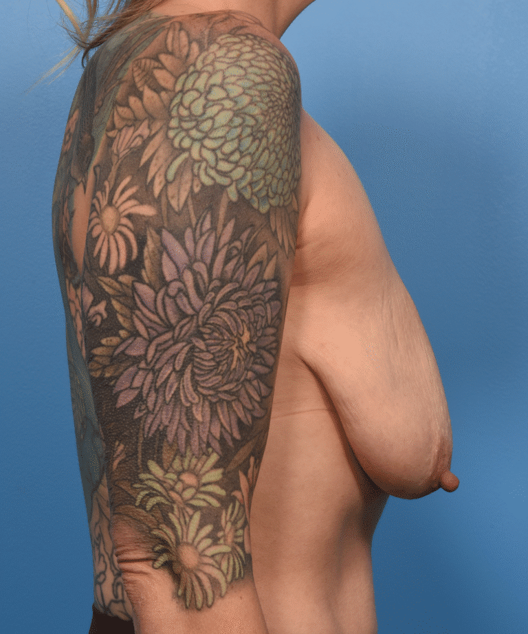 Before Image