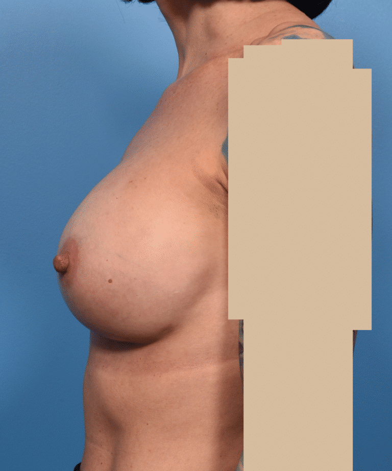 After Image