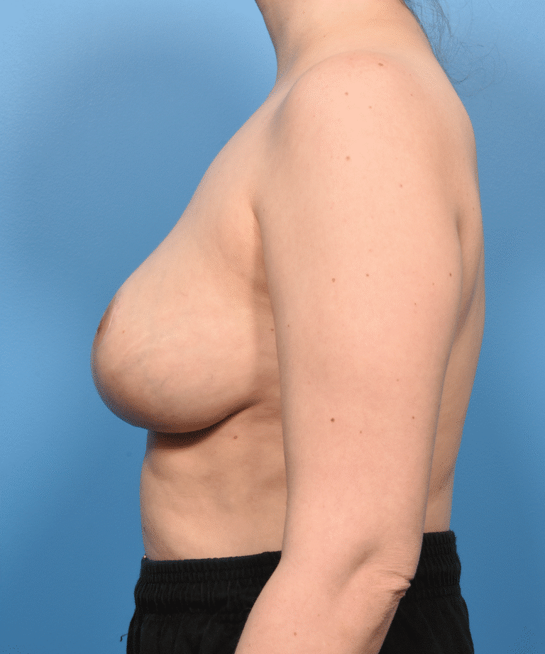 After Image