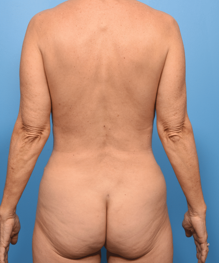 After Image