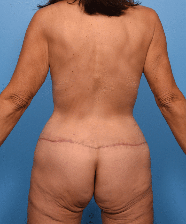 After Image