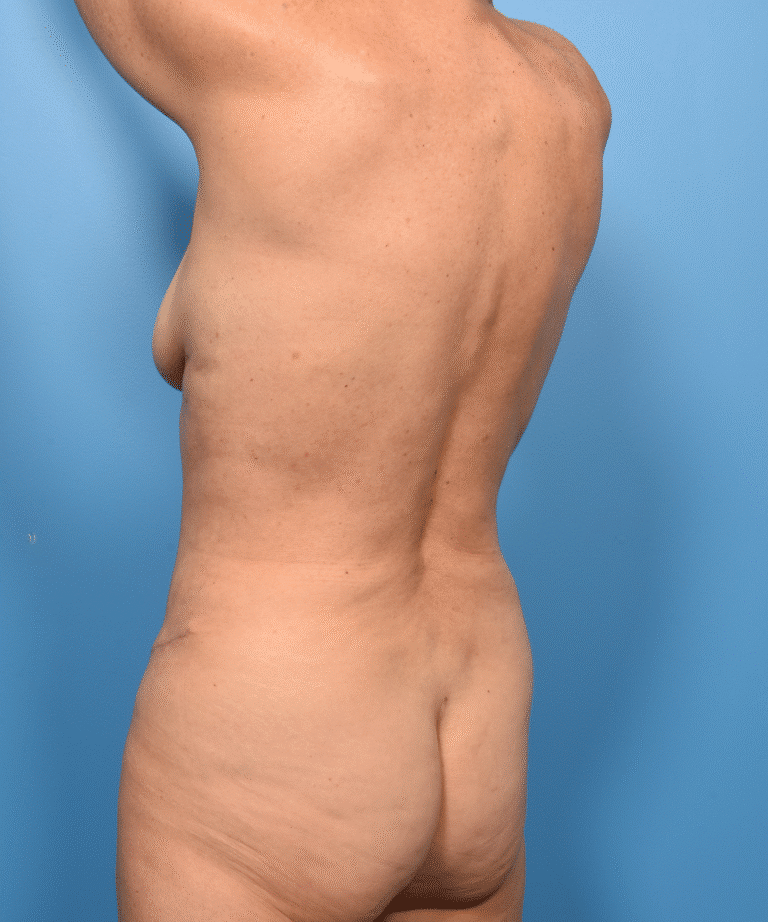 After Image