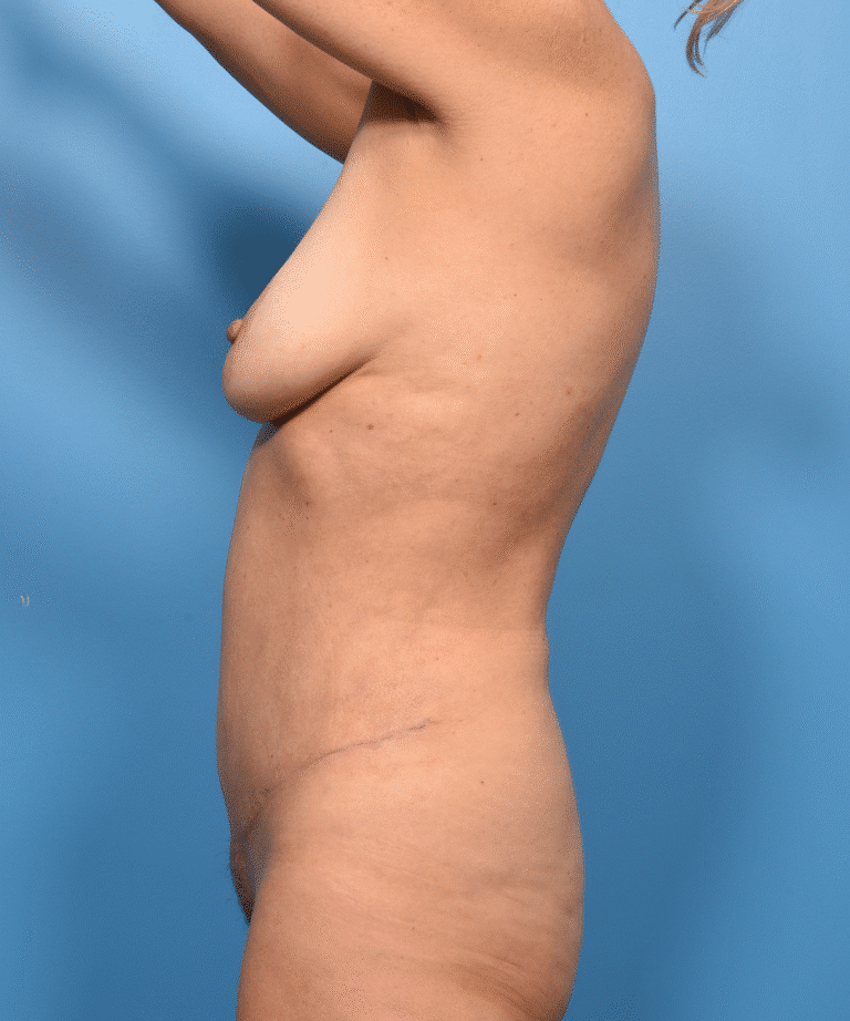 After Image