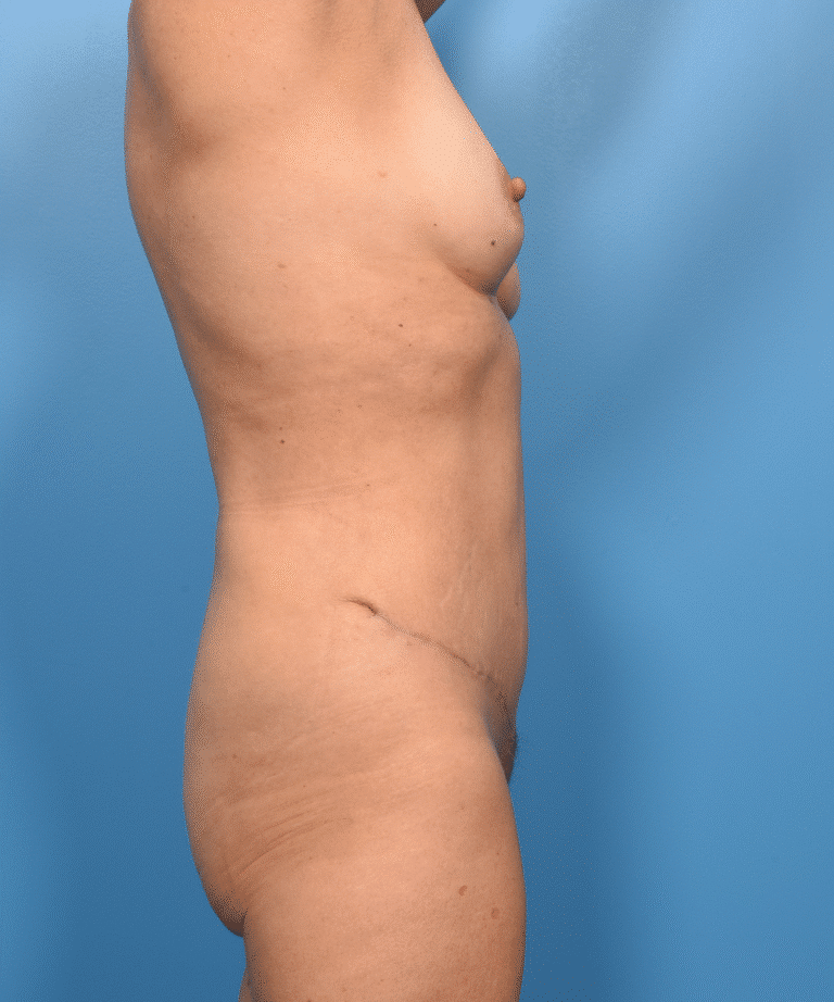 After Image